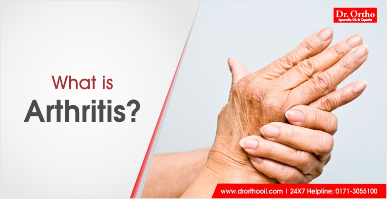 what is Arthritis