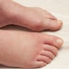 Home-Remedies-to-Get-Rid-of-Swollen-Feet-BLOG